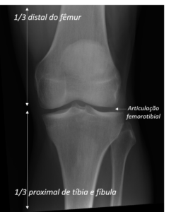Posicionamento Radiol Gico Do Joelho