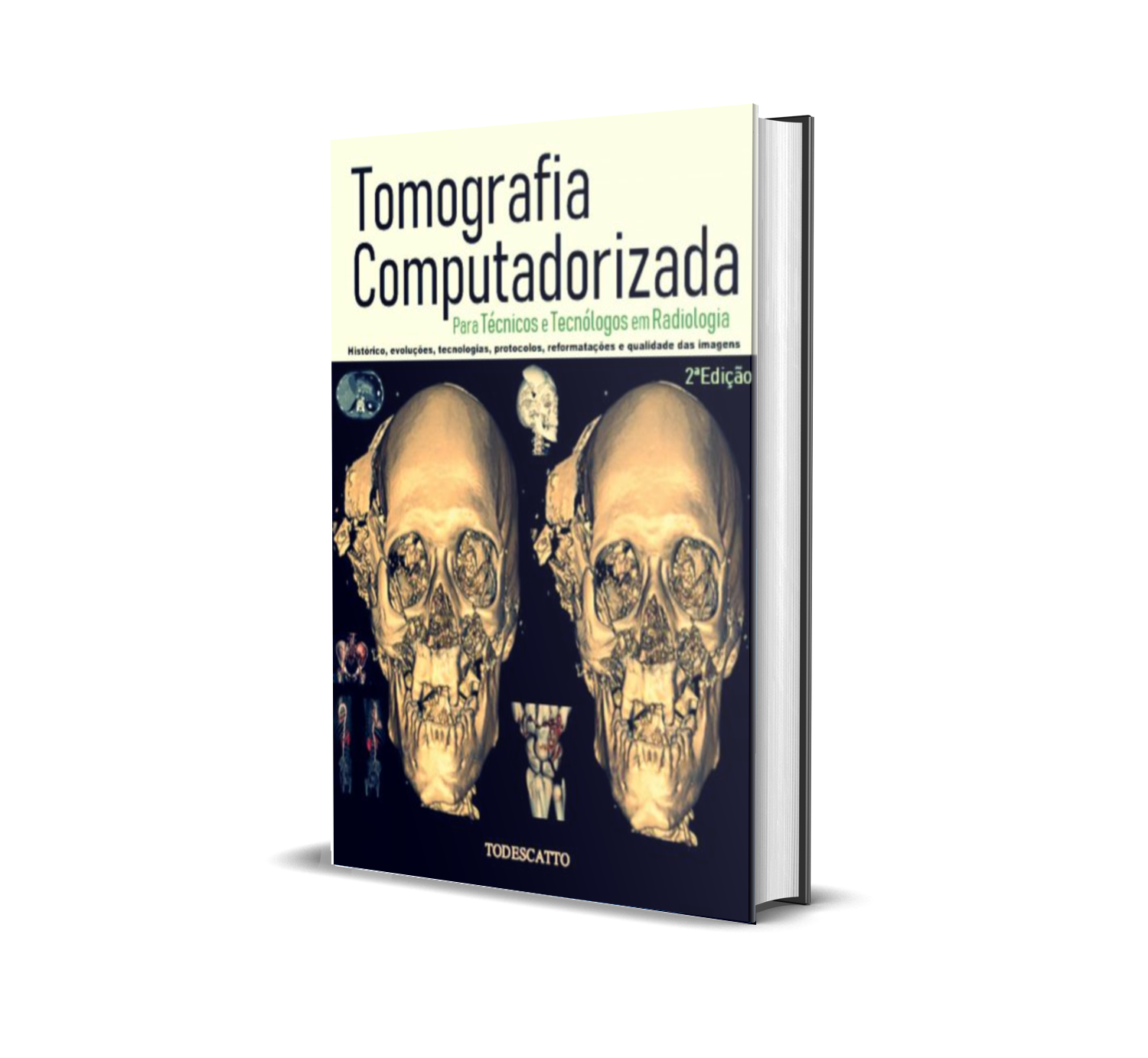 Livro de Tomografia Computadorizada