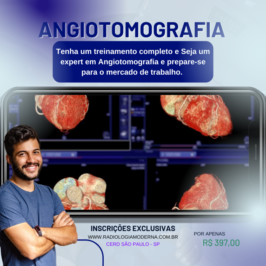 Angiotomografia