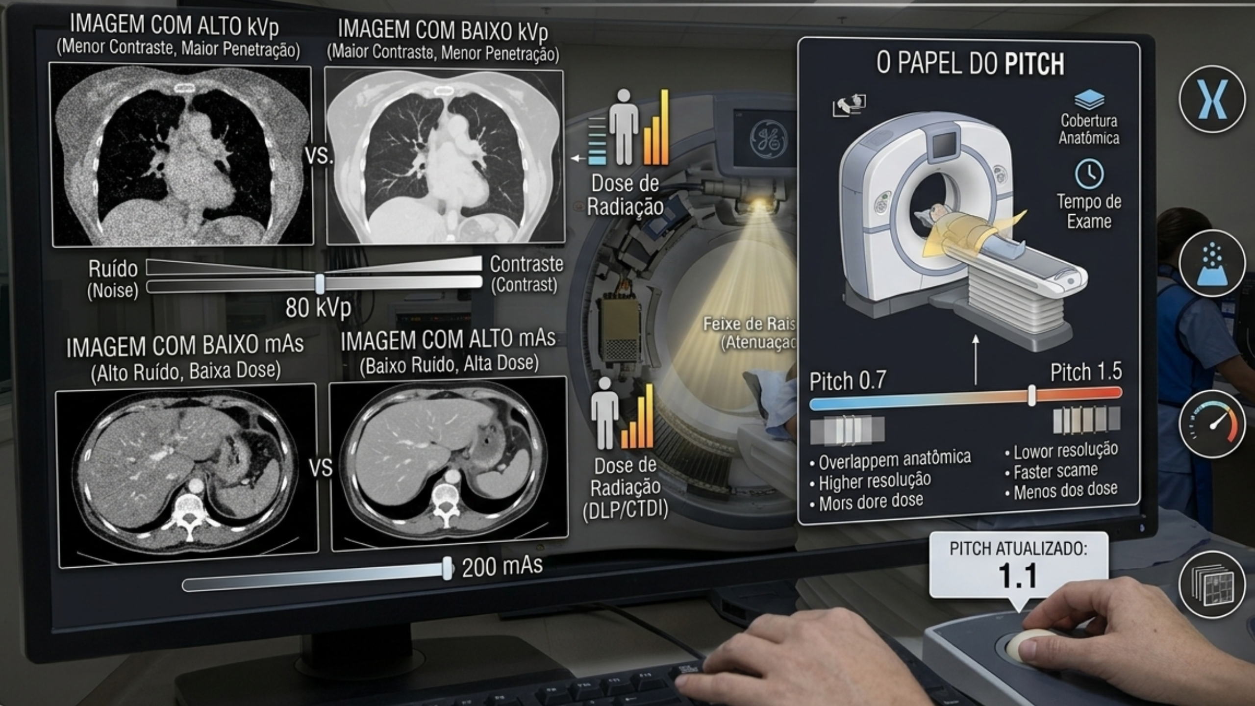 Console de Tomografia Computadorizada mostrando parâmetros técnicos de aquisição