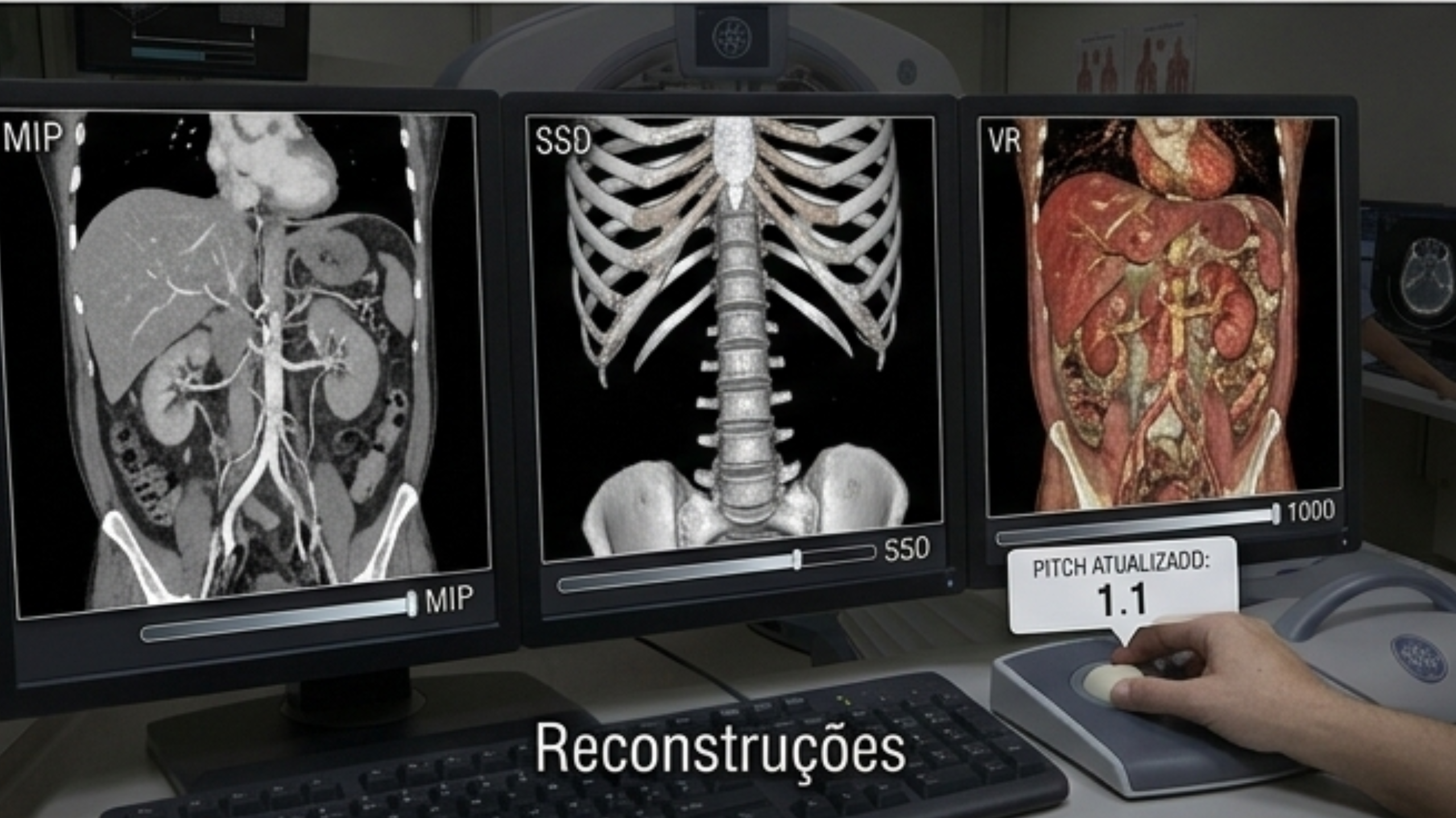 Reconstruções axial coronal e sagital de uma Tomografia Computadorizada